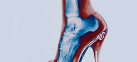 Designer bags, smartphones and high heels could affect your health say NZ Chiropractors